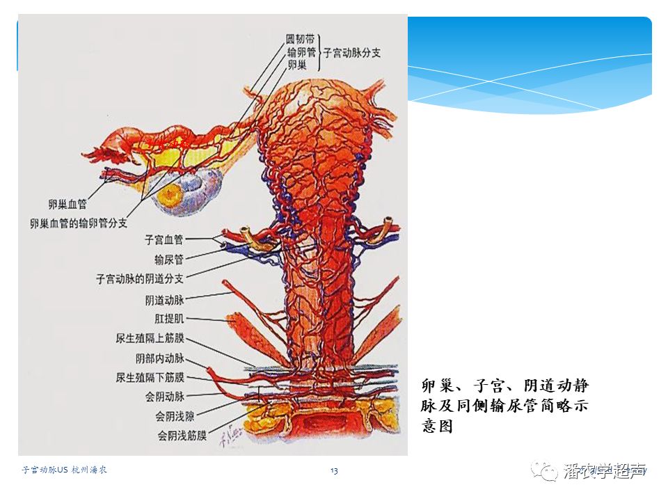 子宫动脉超声检查