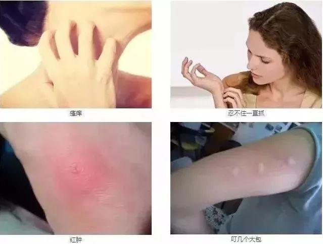 德国变态驱蚊水,喷一次驱蚊12小时!
