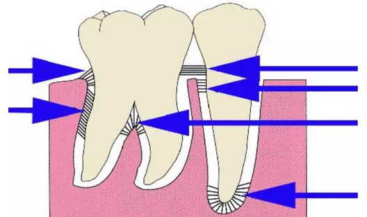相对运动趋势最小,牙周膜变形产生的生理动度可以吸收一定的冲击能量