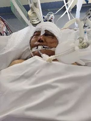 300个小时创造的生命奇迹不仅仅是医护团队的努力更有