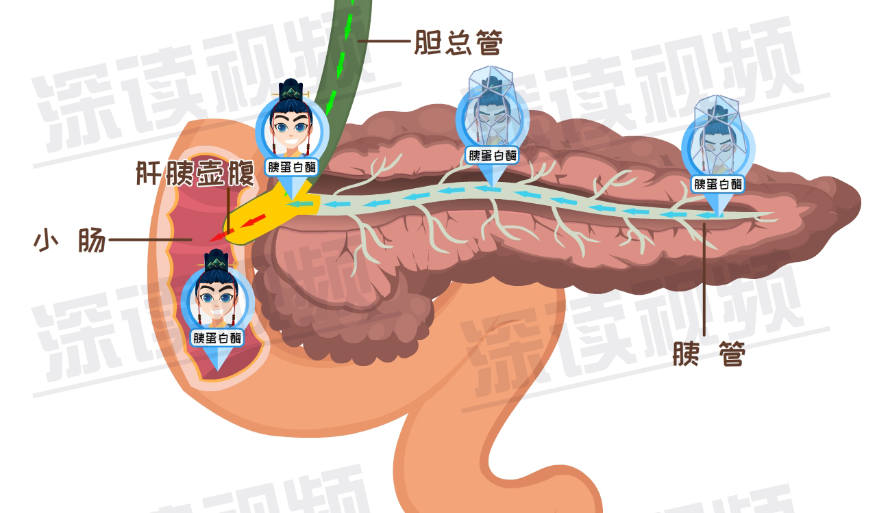 这样吃喝竟会招来高致死率的胰腺炎?预防大全