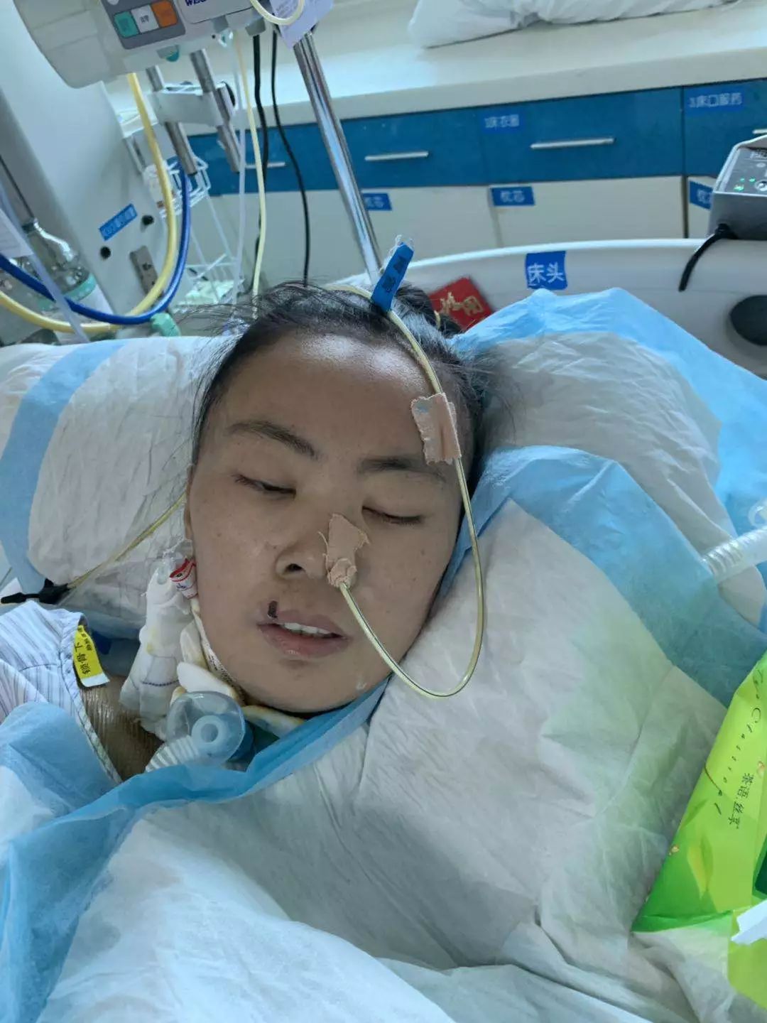 一场感冒……花了80多万,岳阳26岁女子40多天没醒