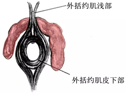 马蹄形肛瘘示意图图片