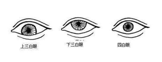 小俗称四白眼,有这种面相的女性身体差,易生疾病或难产,并兼有上下三