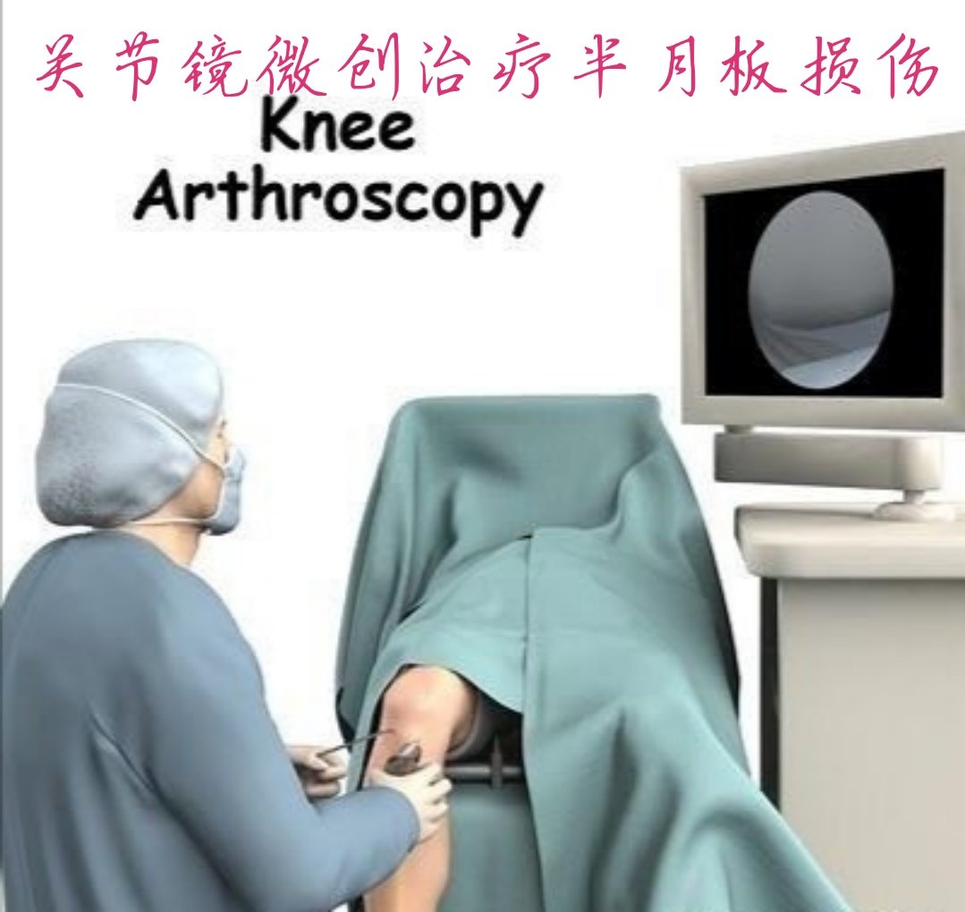 半月板损伤的治疗转载