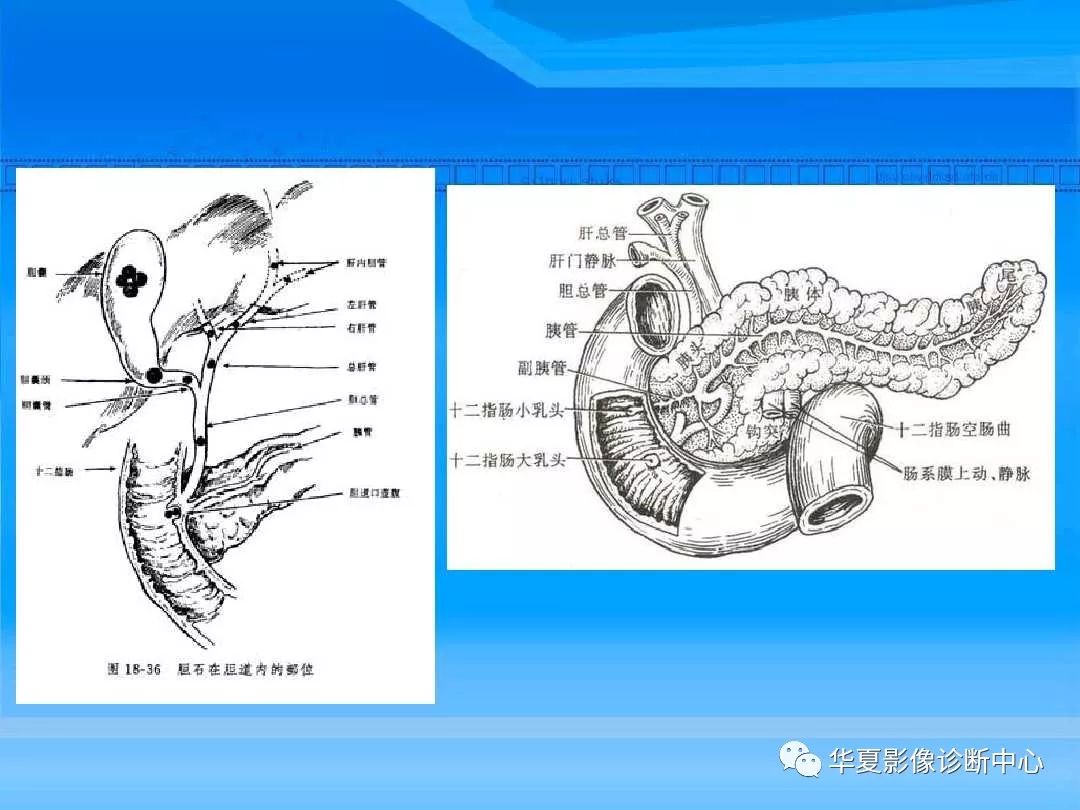 壶腹周围占位的影像学检查方法及诊断价值