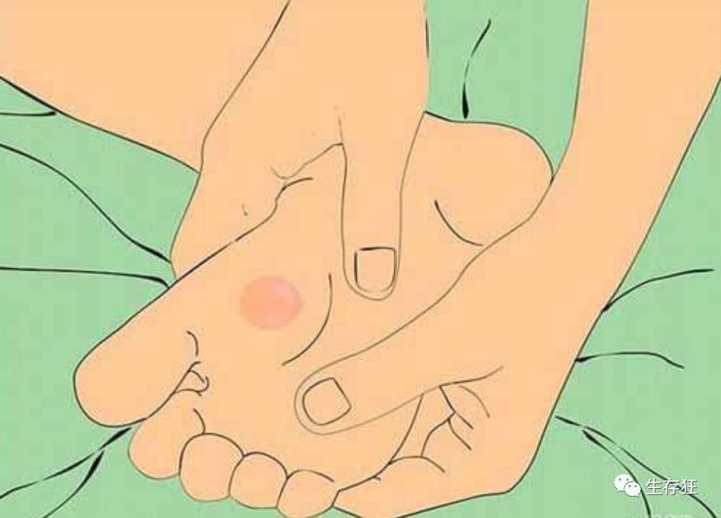 脚上有水泡,户外很烦恼_摩擦