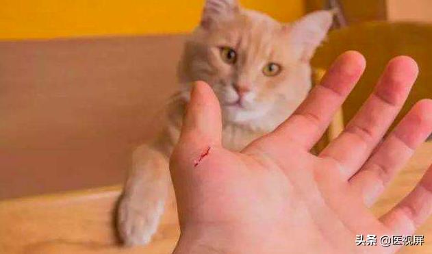 养宠物的人注意了,猫狗咬伤的正确处理姿势!