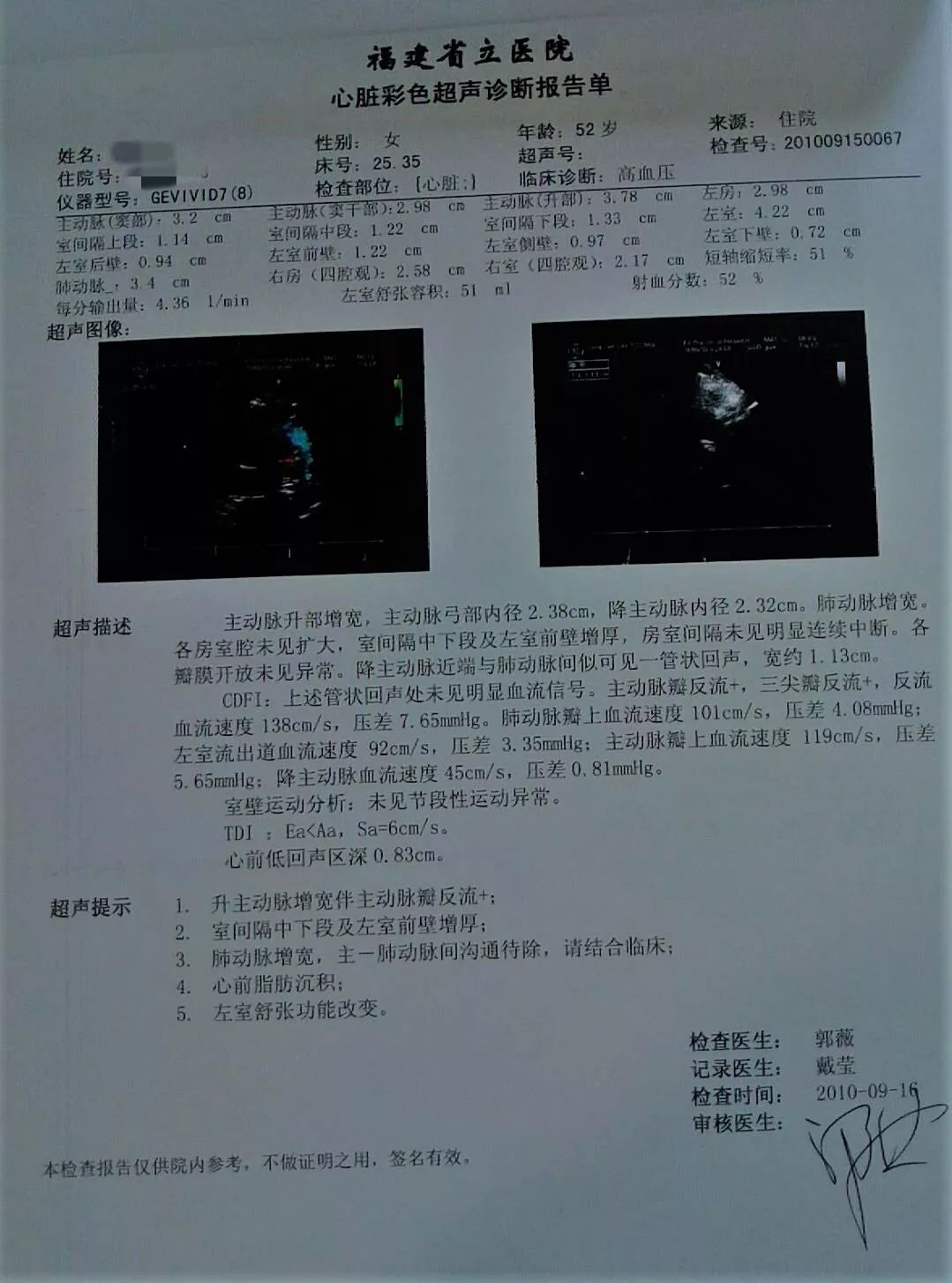 肌钙蛋白 t,nt-probnp 均阴性.