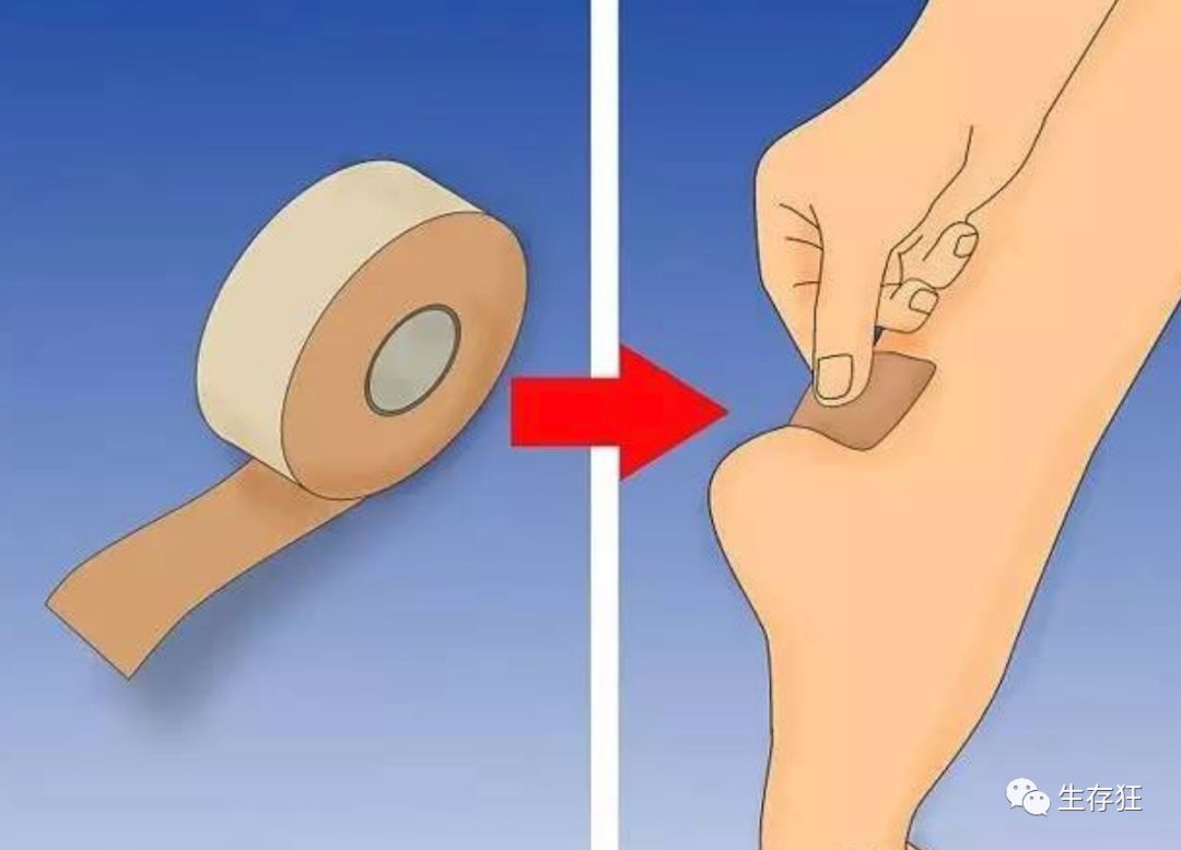 脚上有水泡,户外很烦恼_摩擦