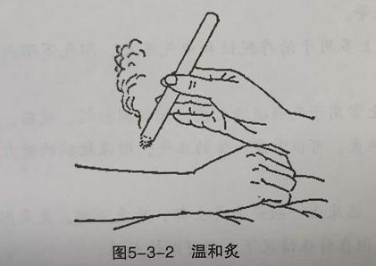 (2)隔盐灸:因本法只用于脐部,又称神阙灸.