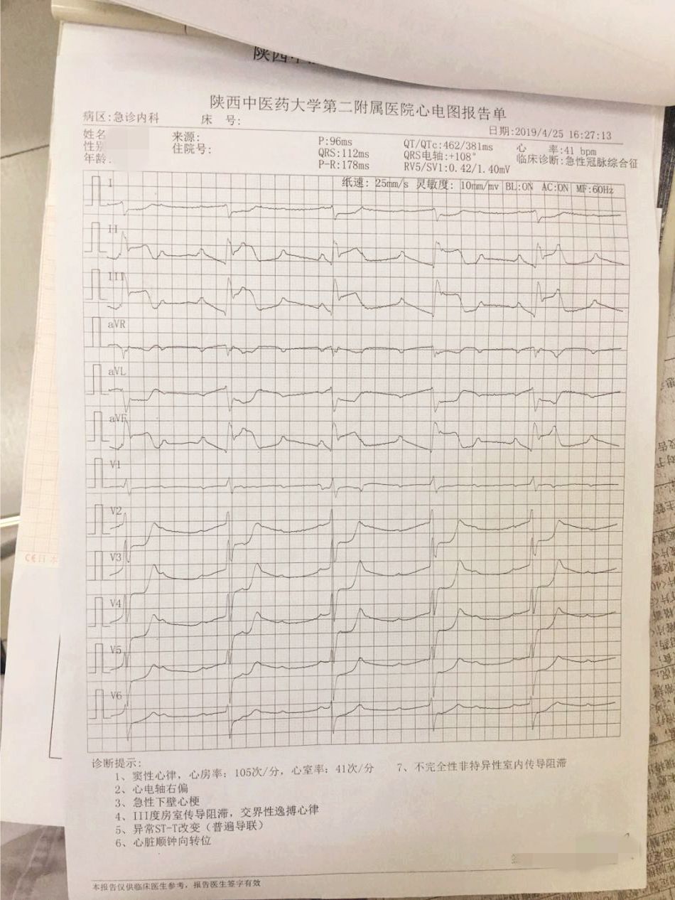 導致相應心肌細胞缺血壞死,是目前影響人類健康以及致死,致殘的主要