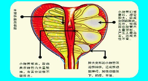前列腺与尿道的结构图图片