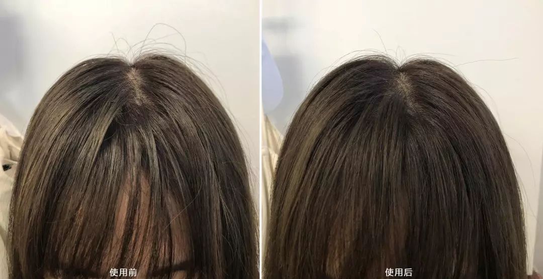 薄荷色初夏薄荷绿初恋裙奶绿色西装两件套射频美容仪法式泡泡袖衬衫