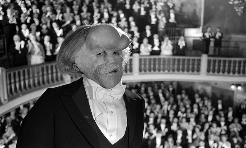 怪异被人戏称为"象人",一生坎坷,最终结局更是令人唏嘘_瑟夫·梅里克