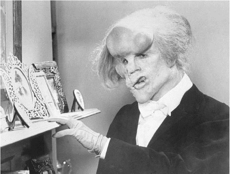 因长相怪异被人戏称为象人一生坎坷最终结局更是令人唏嘘