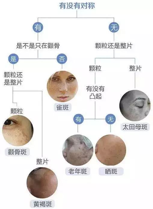 【护肤】郁闷:脸上的斑傻傻分不清~教你一分钟识别各种斑!