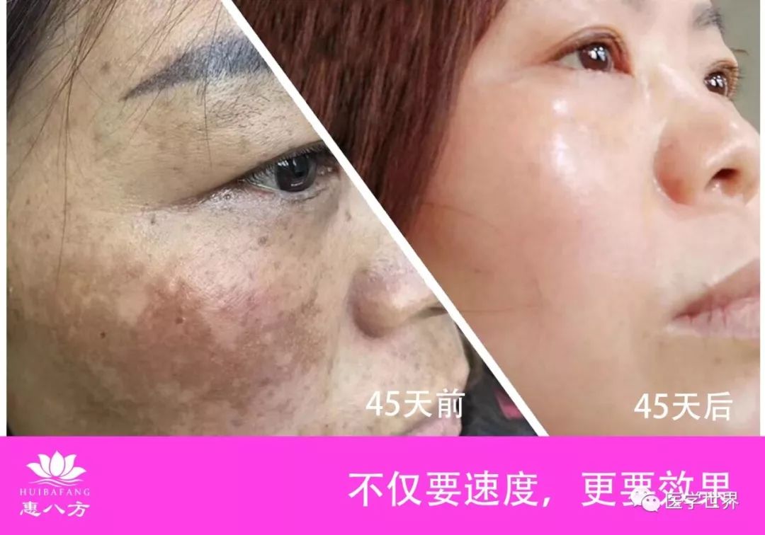 【5月28日-30日】美容祛斑皮肤管理新技术研修班