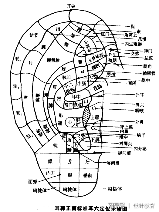 耳轮上有坑图解图片