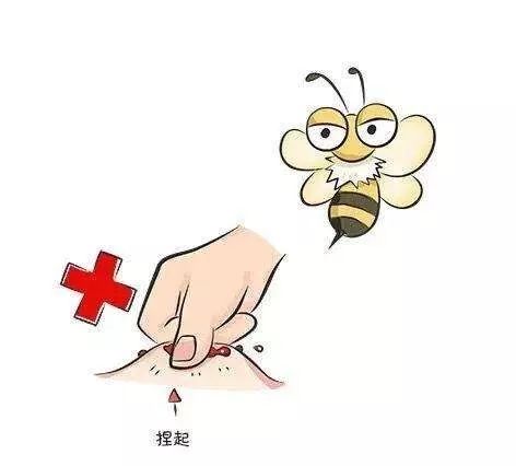 【育儿】驱蚊贴士:蚊子先动口,不如我们先动手