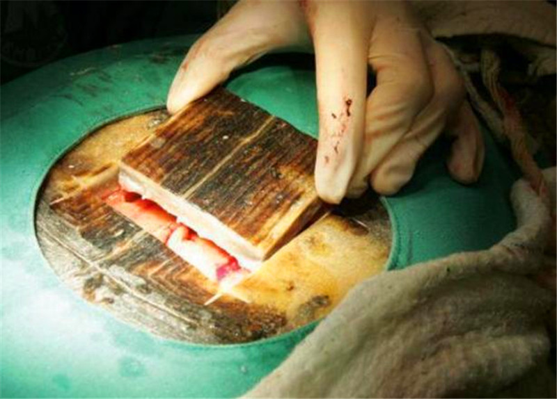 乌龟难产进行剖腹产,拿出电锯的一刹那乌龟心理阴影面积多少!