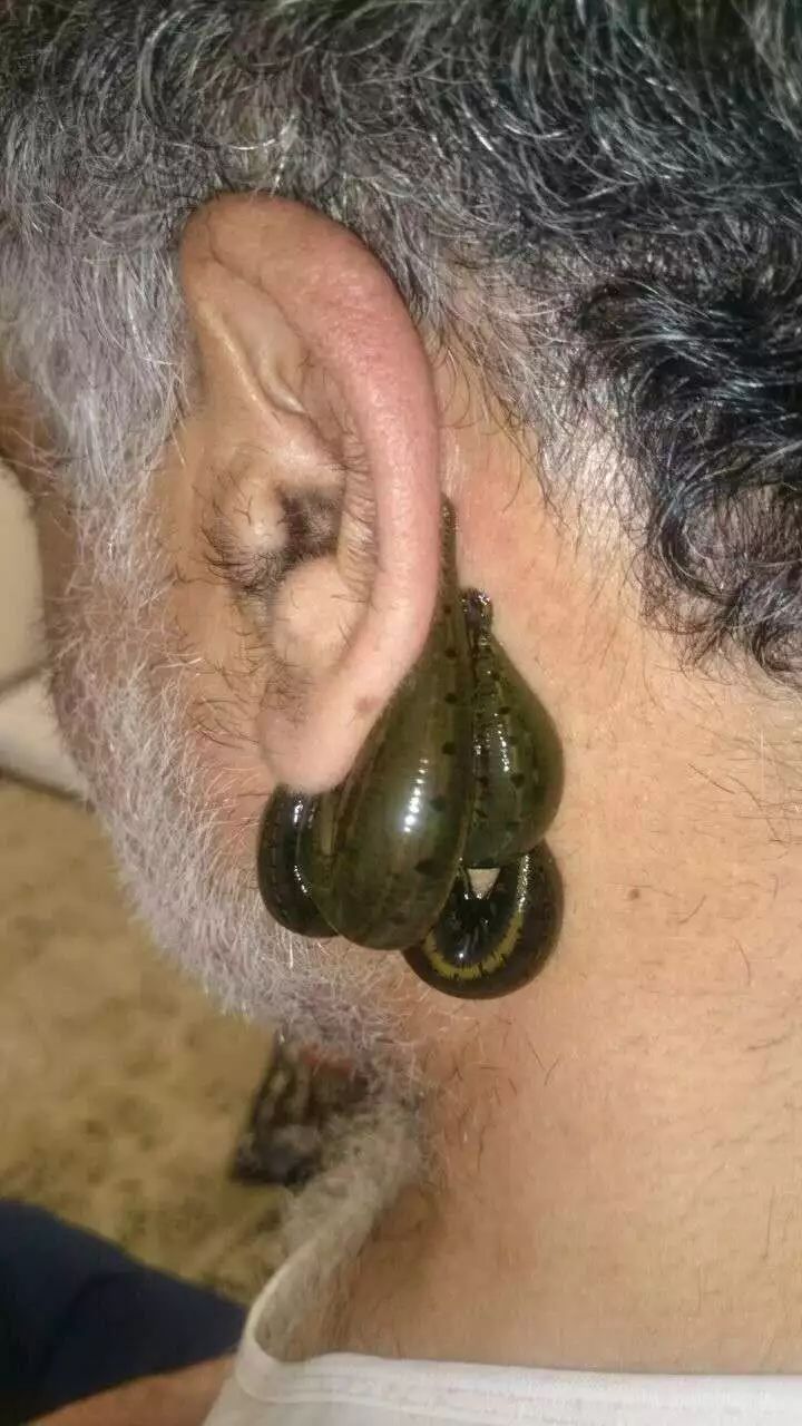 水蛭疗法的前世今生丨欢迎投稿traditional medicine research