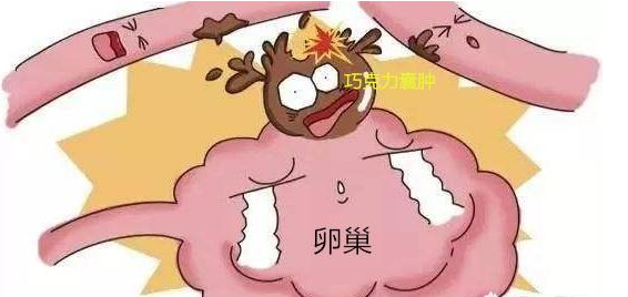 备孕的女性患巧克力囊肿需要手术吗?手术后还能不能怀孕呢?