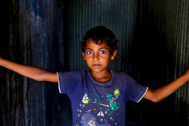 现实中拥有超能力和眼睛很奇特的小孩