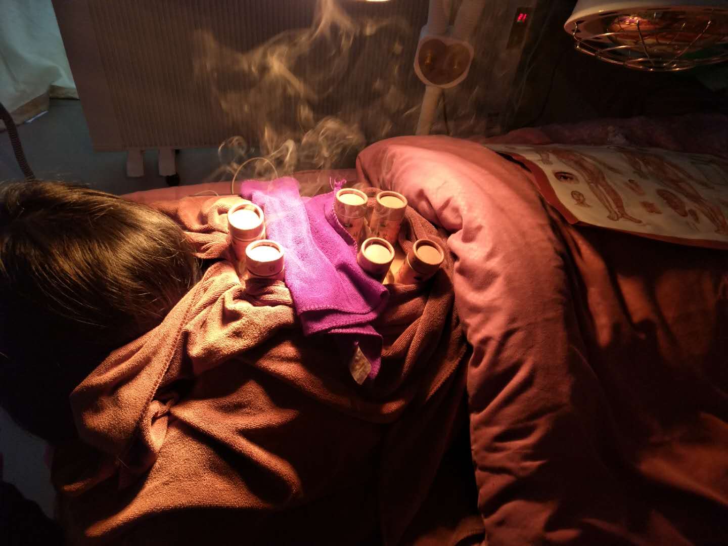 肚子大,下肢变大,湿气太重啦!赶快艾灸吧