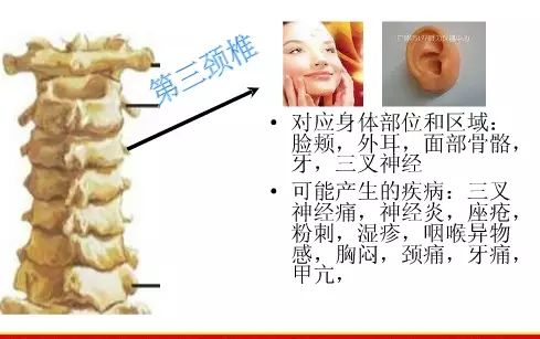 頸椎胸椎腰椎與全身的疾病的對照圖