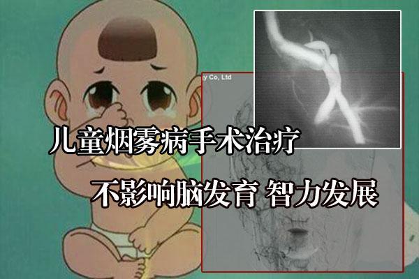 儿童烟雾病手术治疗后能跟正常孩子上学学习吗