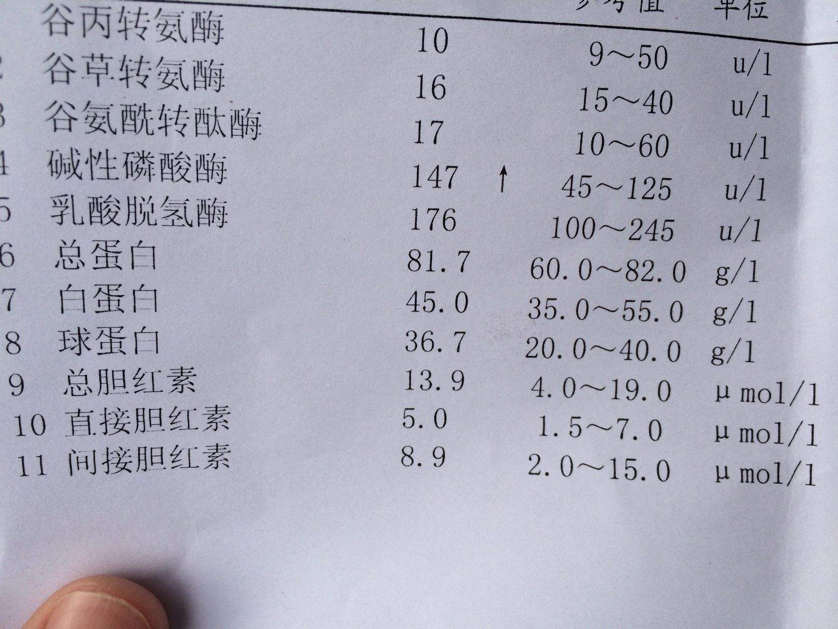 轻度肝硬化化验单图片