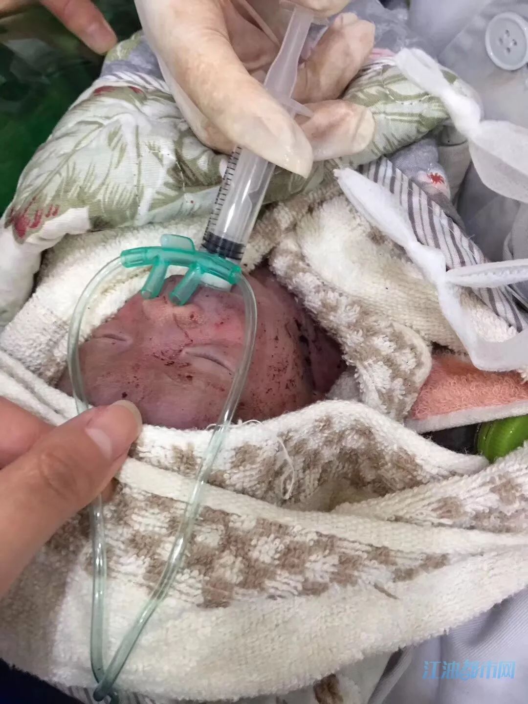 2019年5月8日下午在含增附近水沟里发现女弃婴一名,呼吸微弱,皮温很低