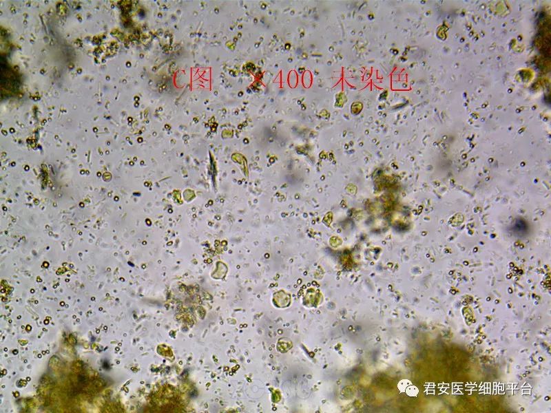 03結腸內阿米巴滋養體和人芽囊原蟲02受精蛔蟲卵和人芽囊原蟲01再看