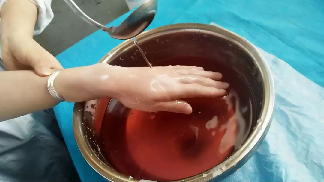 神奇的中医蜡疗他们做完治疗后顺手做了朵花