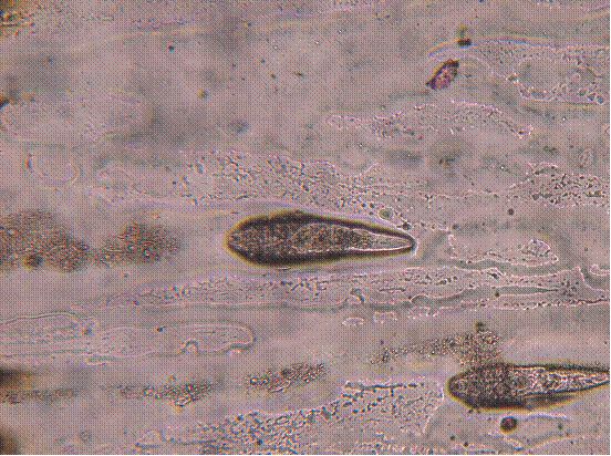 图3,耳垢中的蠕形螨镜检照片.图片来自luisa cornegliani.