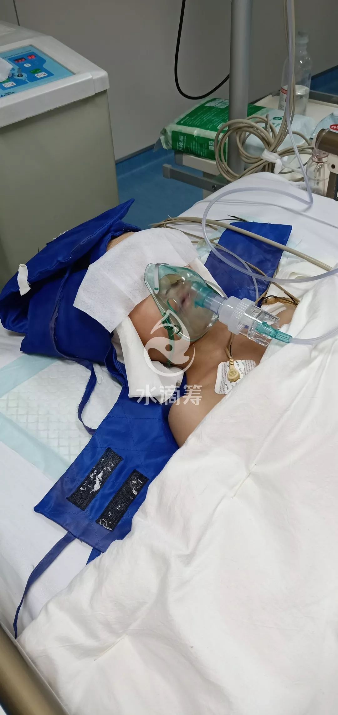 淅川上集7岁男孩摔至脑出血!急需好心人帮助!