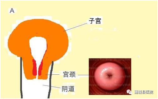 什么是宫颈真实照片图片