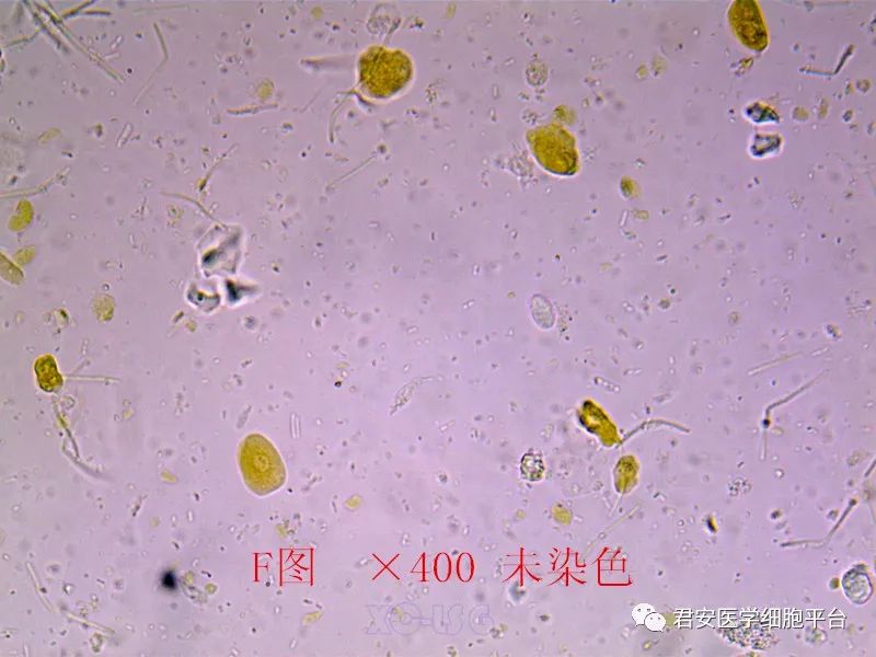 鞭毛蟲和人芽囊原蟲03結腸內阿米巴滋養體和人芽囊原蟲02受精蛔蟲卵和