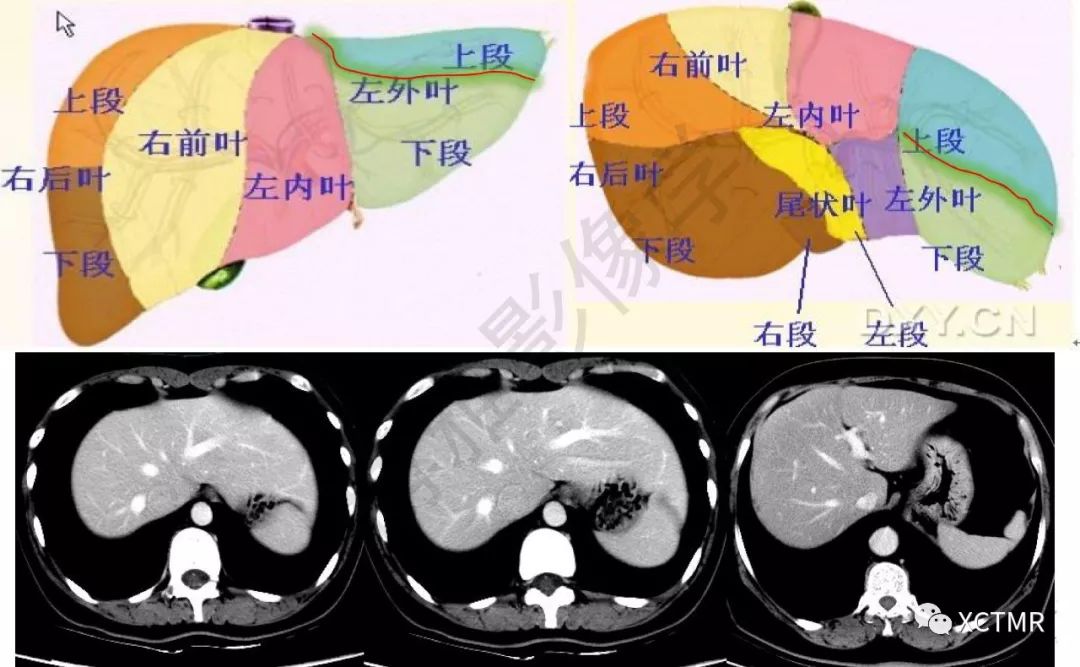 肝脏分叶分段的影像学解剖