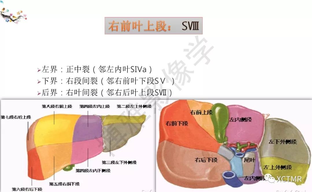肝脏分叶分段的影像学解剖
