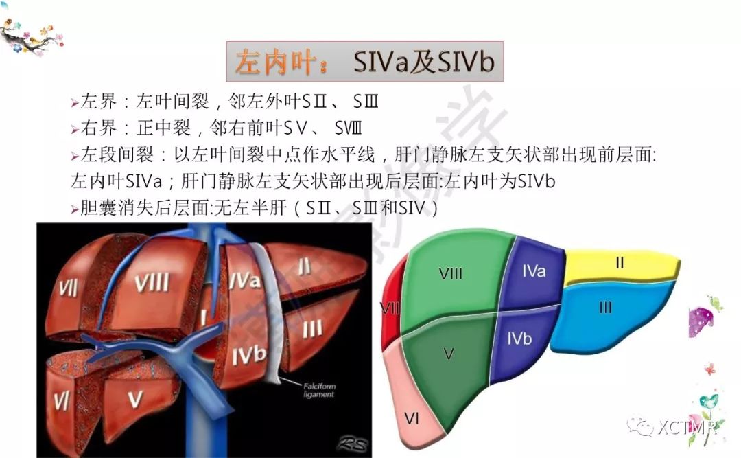 肝脏分叶分段的影像学解剖