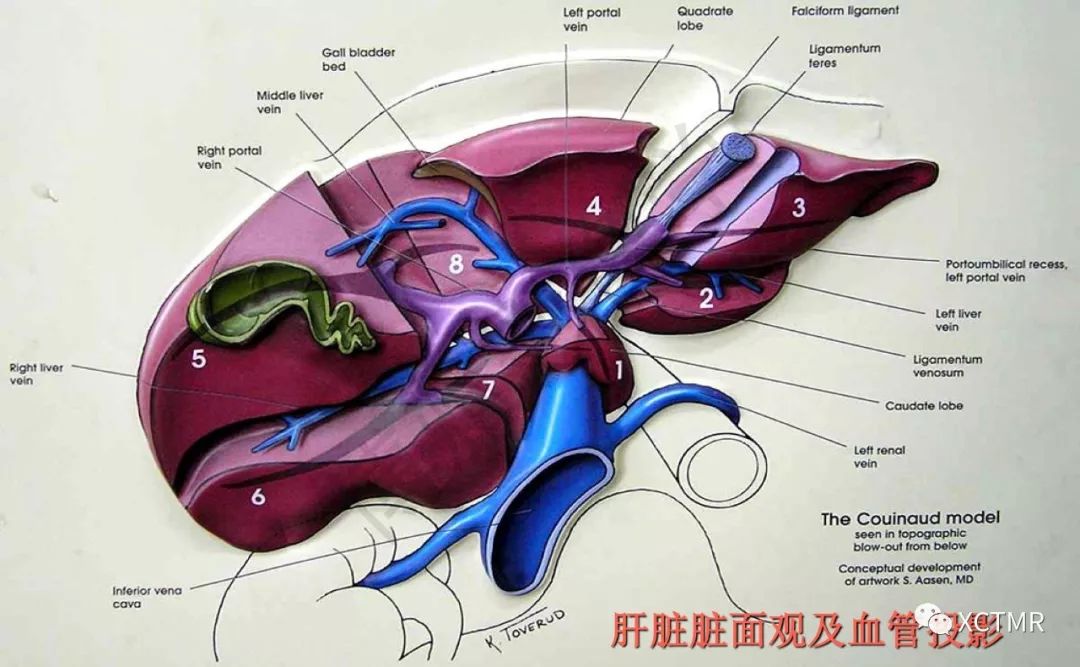 肝臟分葉分段的影像學解剖