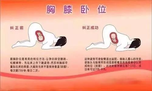 改变胎位的跪法示意图图片