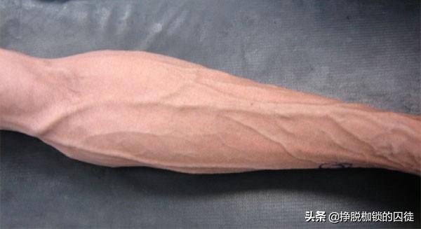 手臂上青筋暴跳是哪里出了问题