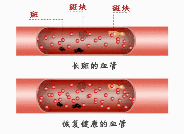 御合源健康分享血管年龄直接关乎你的健康和寿命快来看一看
