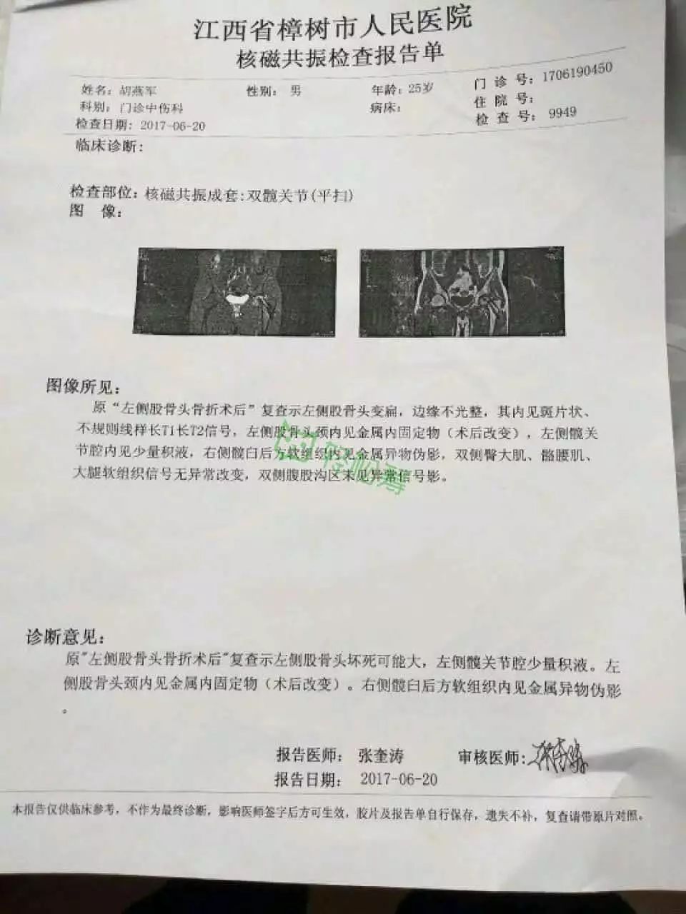 【献爱心】八景胡家坊的这位帅哥因车祸股骨头坏死,急需大家的帮助!