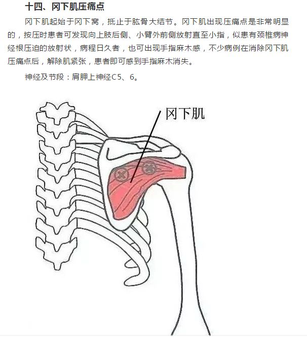 软组织常见压痛点_损伤