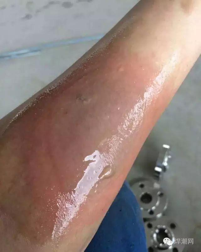 焊工在流血焊嫂在流泪到底是谁的错