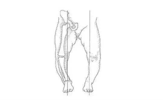 宝宝走路外八字罗圈腿你家宝宝也这么走路么